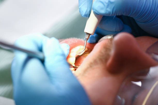 Best Teeth Whitening  in Lusk, WY