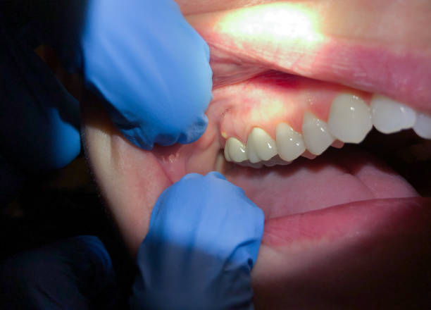 Best Emergency Dental Services Near Me  in Lusk, WY