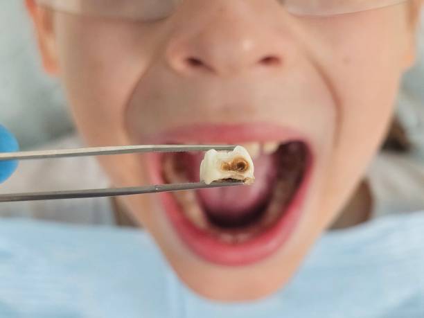 Best Emergency Dentist for Kids  in Lusk, WY